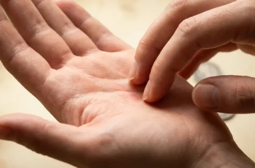 person scratching the center of their left palm with the fingertips of the right hand, illustrating the spiritual meaning of left palm itching linked to money coming in